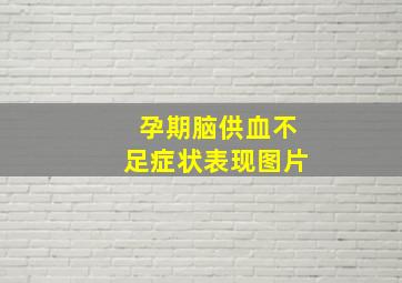 孕期脑供血不足症状表现图片