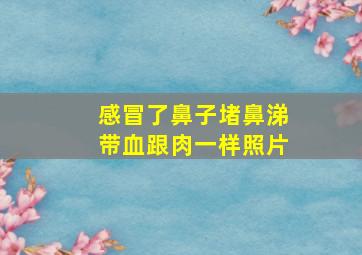 感冒了鼻子堵鼻涕带血跟肉一样照片