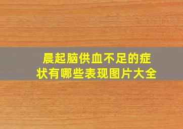 晨起脑供血不足的症状有哪些表现图片大全