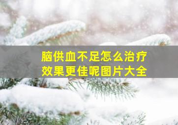 脑供血不足怎么治疗效果更佳呢图片大全