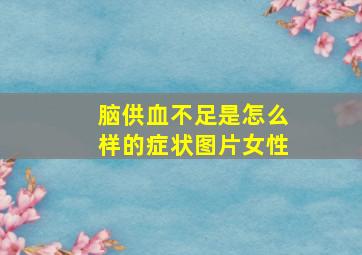 脑供血不足是怎么样的症状图片女性