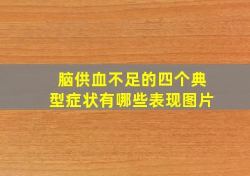 脑供血不足的四个典型症状有哪些表现图片