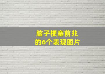 脑子梗塞前兆的6个表现图片