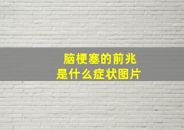 脑梗塞的前兆是什么症状图片