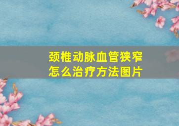 颈椎动脉血管狭窄怎么治疗方法图片