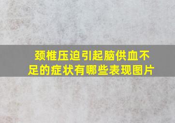 颈椎压迫引起脑供血不足的症状有哪些表现图片