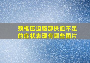 颈椎压迫脑部供血不足的症状表现有哪些图片