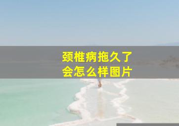 颈椎病拖久了会怎么样图片