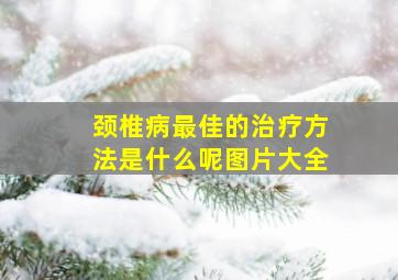 颈椎病最佳的治疗方法是什么呢图片大全