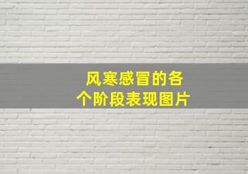 风寒感冒的各个阶段表现图片