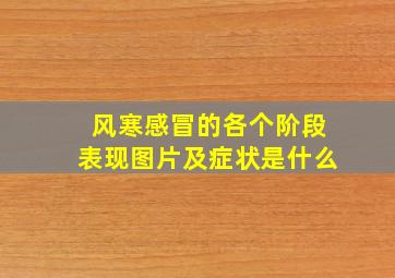 风寒感冒的各个阶段表现图片及症状是什么