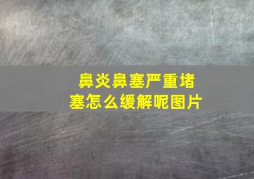 鼻炎鼻塞严重堵塞怎么缓解呢图片